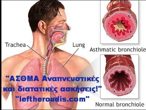 Fucicort παρενεργειες